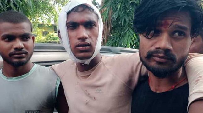 ऋषिकेश: मजदूर पर ठेकेदार ने कराया हमला, जख्मी हालत में पहुंचा कोतवाली